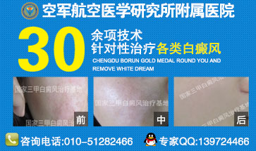 ���综�߸������ʳ