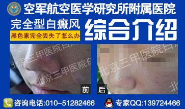 ���综�ߵ���ʳӦע����Щ����