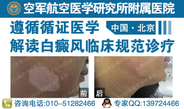 ���˰���Ļ���ԭ����ʲô