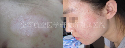 Ů����հװ�1�꣬����Ժ����