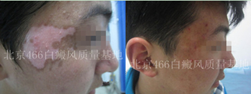 �����沿����������