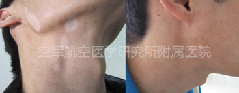 ����2�� �����Ϊ�������·��