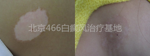 Ů�Ա�������2��