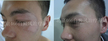 �����沿����20��