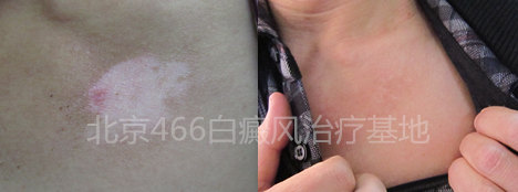 �����ز��������