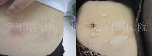 ������磬����Ժ�ĸ����κ�