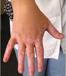 �ֲ��װ��ǰ�����