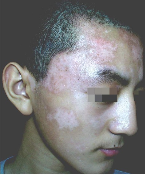 ������ư���Ч����ô��